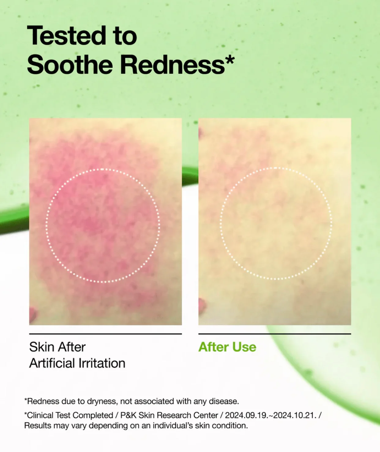 Anua Azelaic Acid 10+ Hyaluron Redness Soothing Serum - Image 5