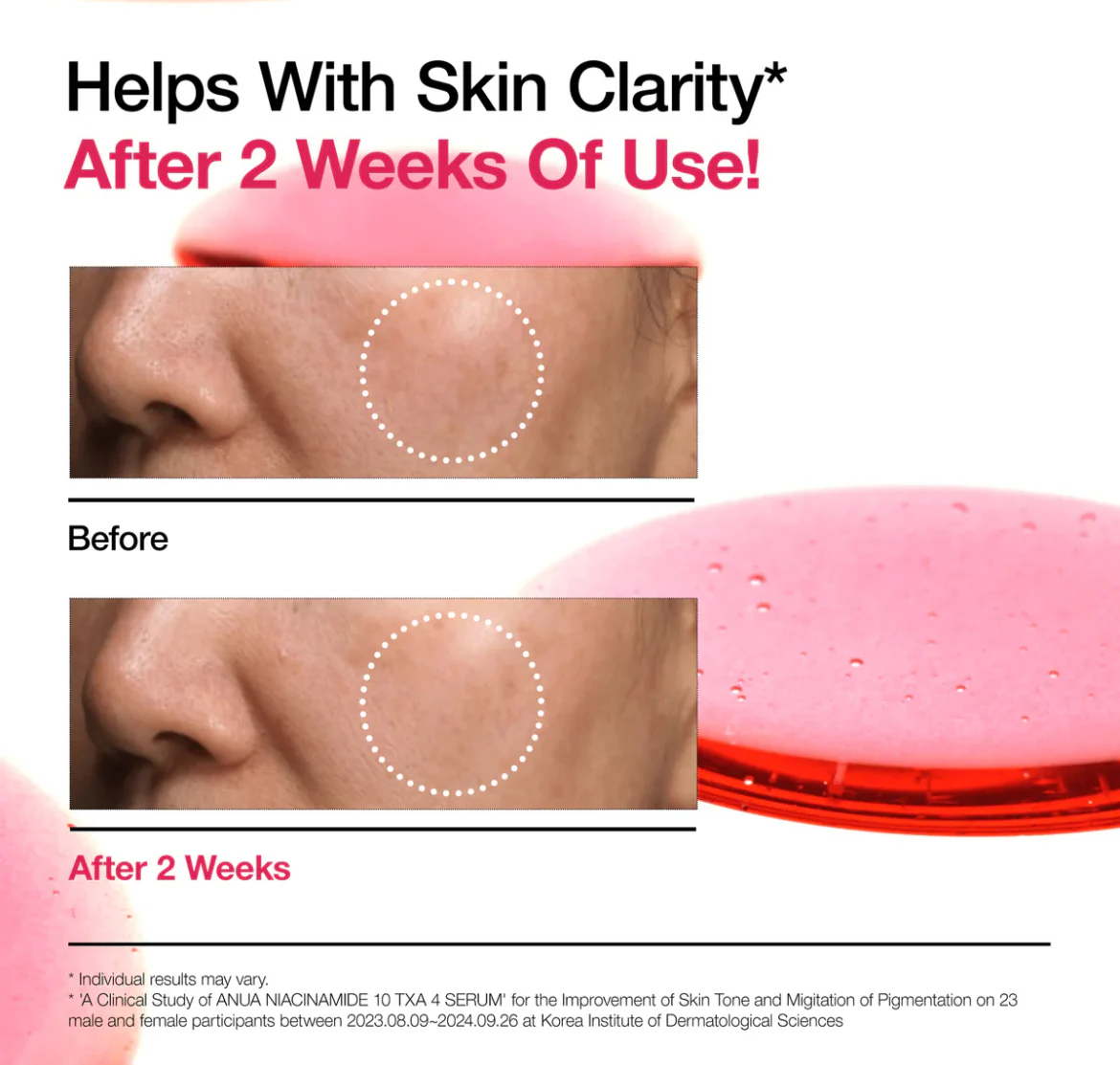 ANUA NIACINAMIDE 10%+TXA 4% DARK SPOT CORRECTING SERUM - Image 5