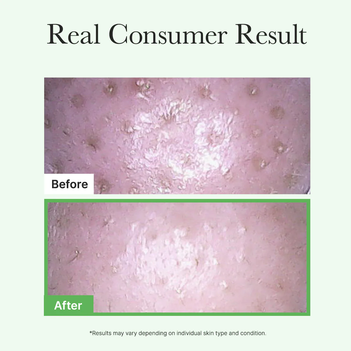 Arencia Pore Melt Mochi Makeup Removing Cleansing Oil - Image 7