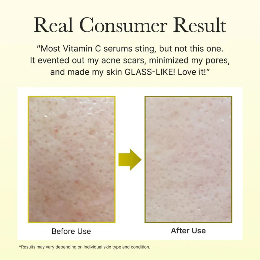 ARENCIA VITAMIN C BOOSTER SHOT - Image 7