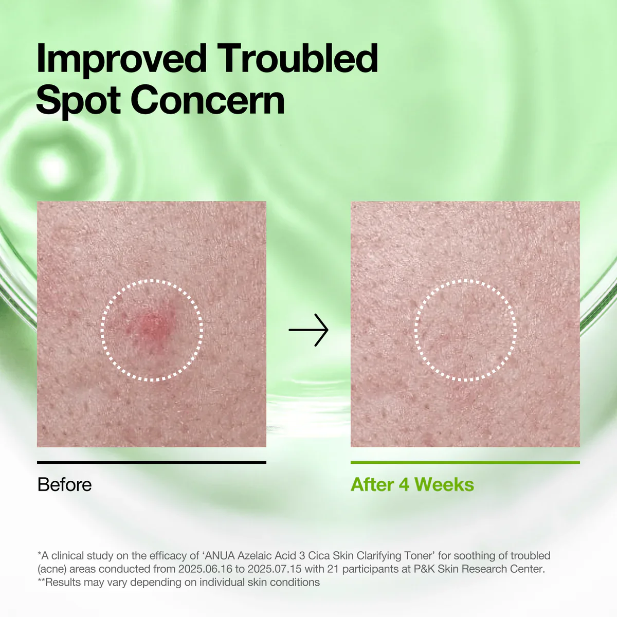 ANUA Azelaic 3+ Cica Skin Clarifying Toner - Image 3