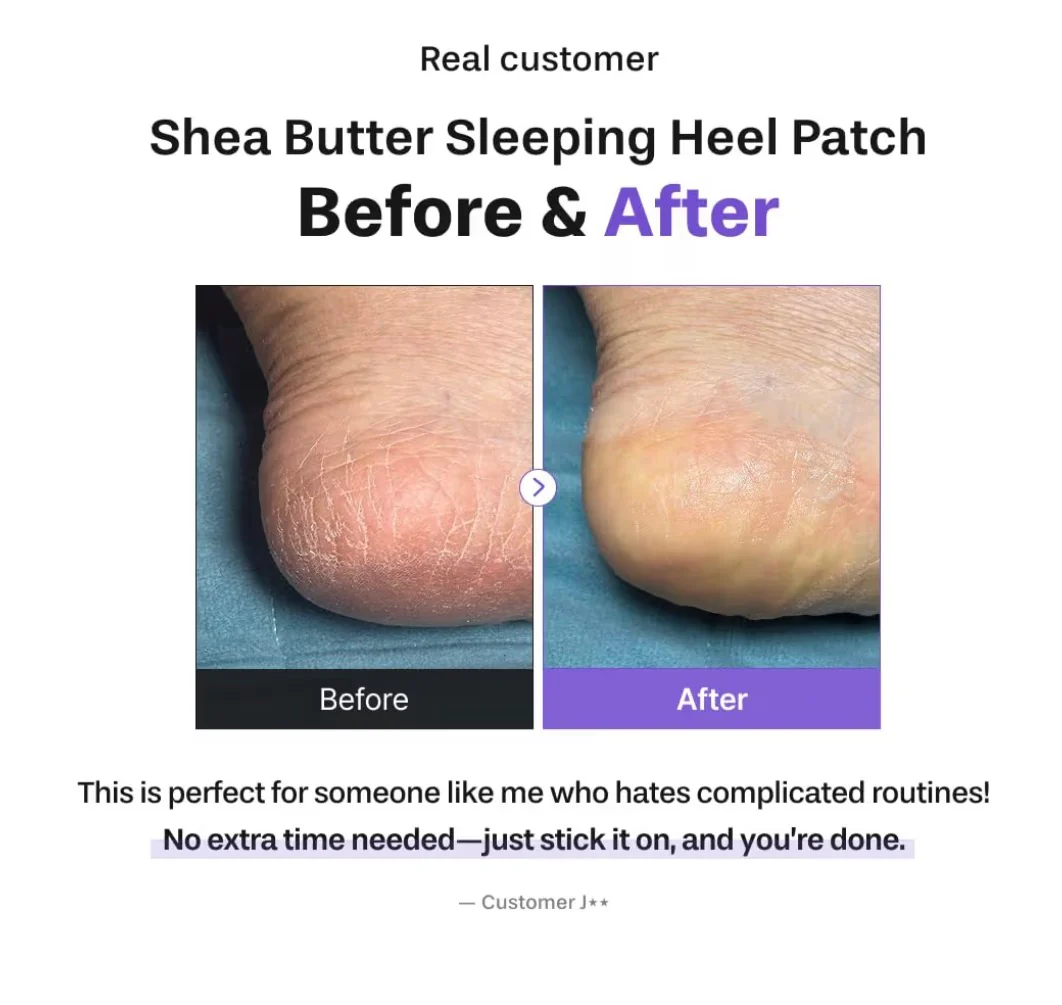 Baren Shea Butter Sleeping Heal Patch - Image 6