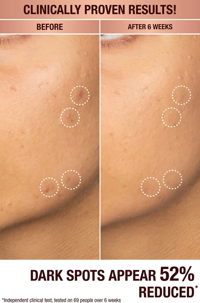 Charlotte Tilbury Dark Spot Correcting Radiance Serum (sample size) - Image 2