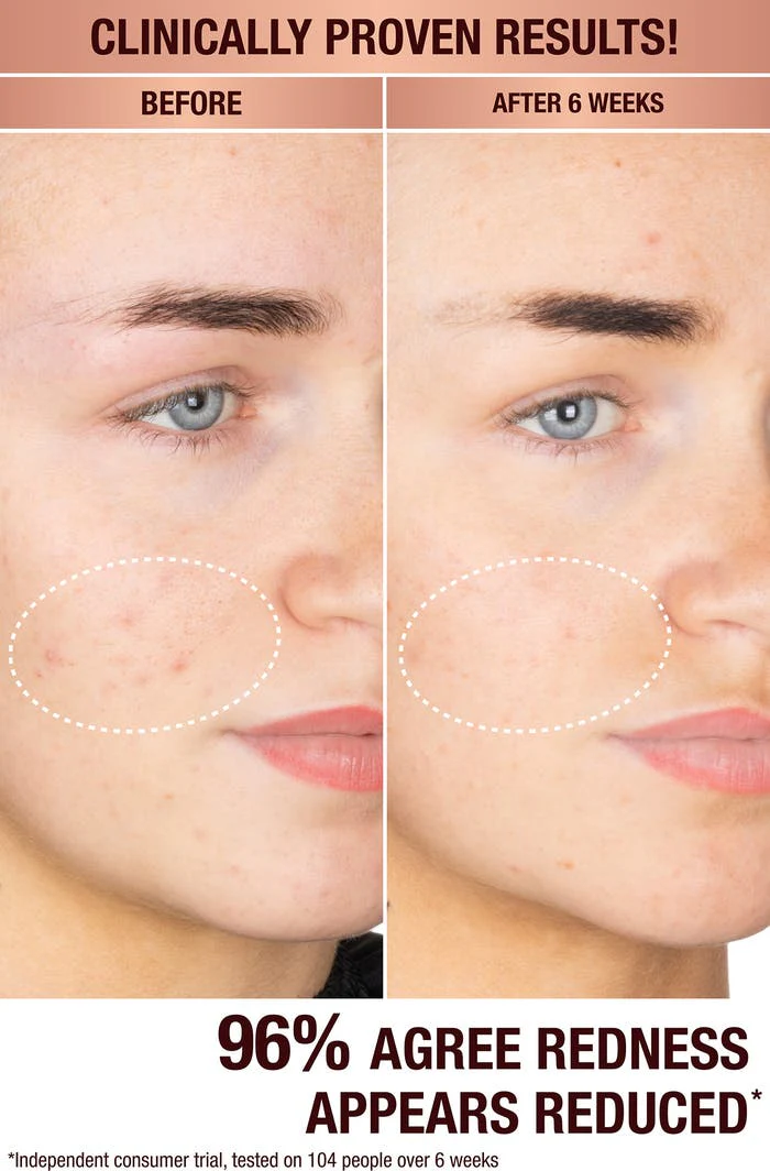 Charlotte Tilbury Dark Spot Correcting Radiance Serum (sample size) - Image 3