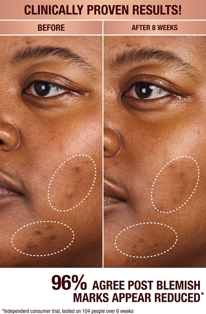Charlotte Tilbury Dark Spot Correcting Radiance Serum (sample size) - Image 4