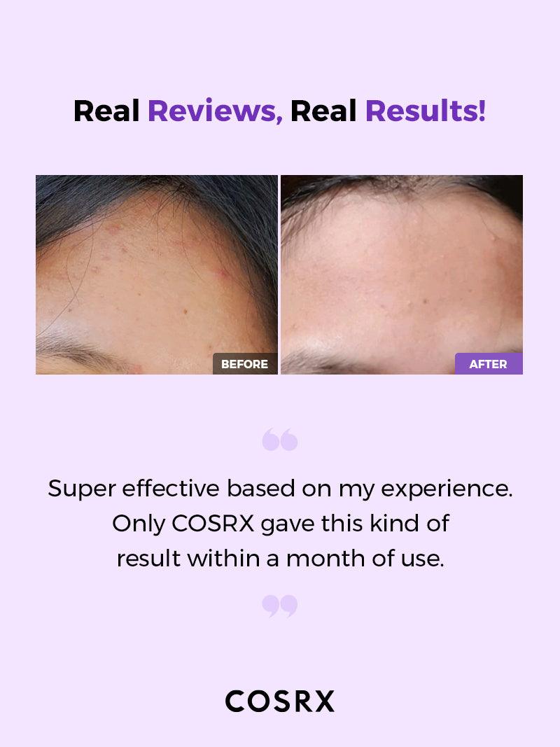 COSRX AHA/BHA Clarifying Treatment Toner - Image 5