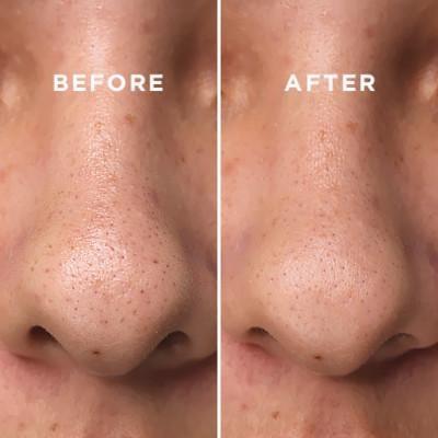 COSRX Two in One Poreless Power Liquid - Image 4