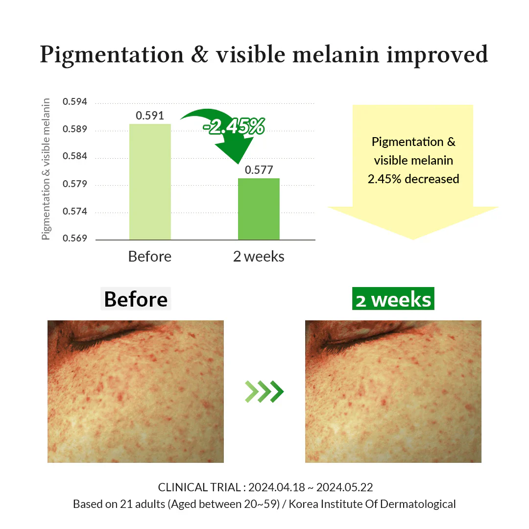 DR.ALTHEA Gentle Vitamin C Serum 20% - Image 6