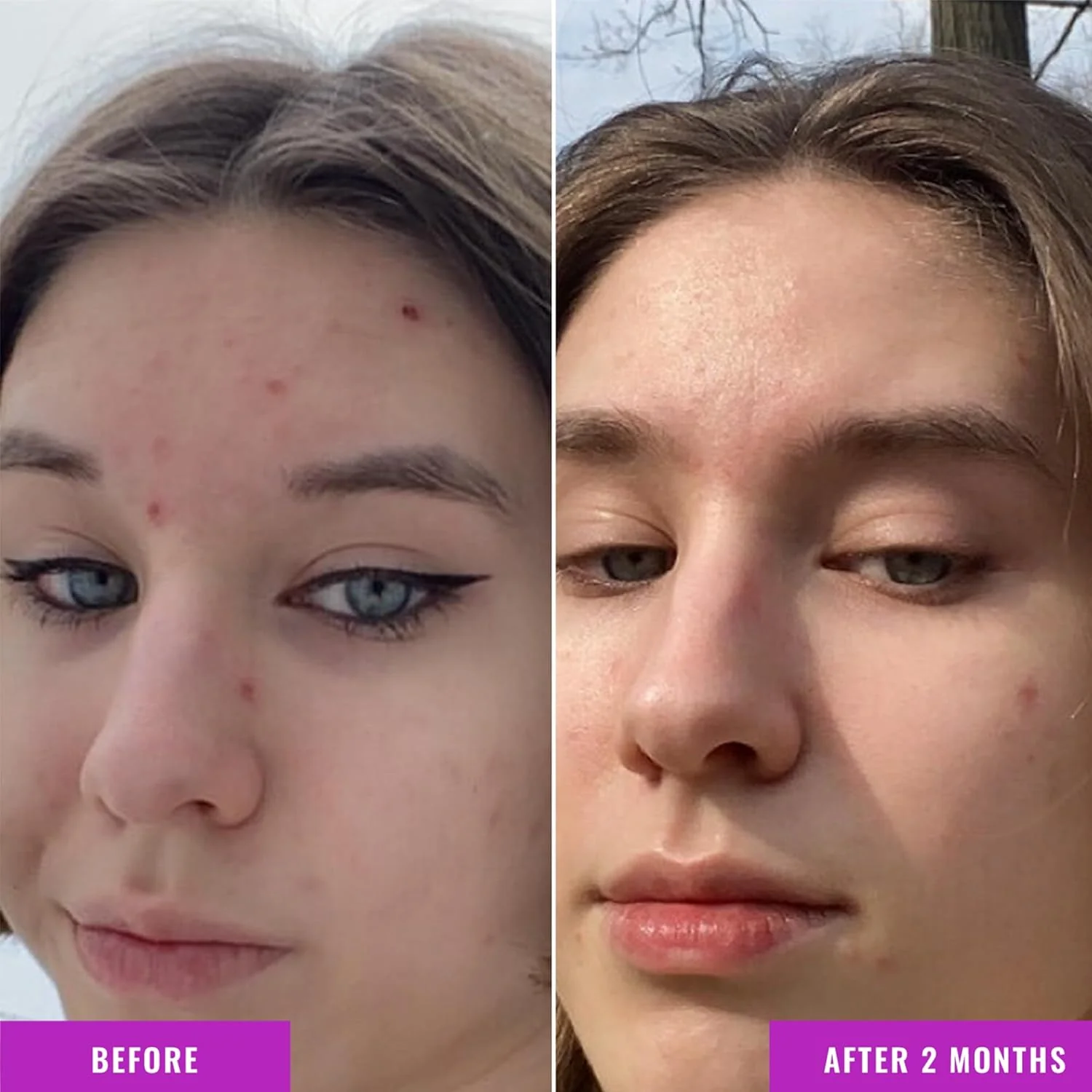 Good Molecules Niacinamide Serum - Image 5