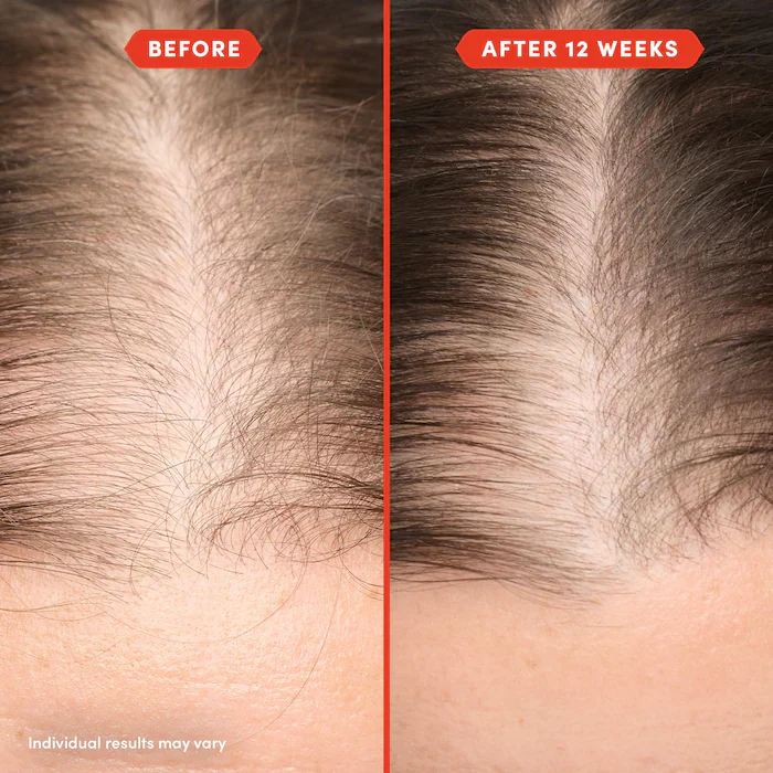 Fable & Mane HoliRoots Pre-Wash Treatment Oil for Thinning Hair - Image 12