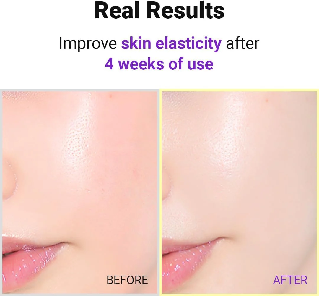 ISNTREE Hyper Retinol EX 1.0 Serum - Image 8