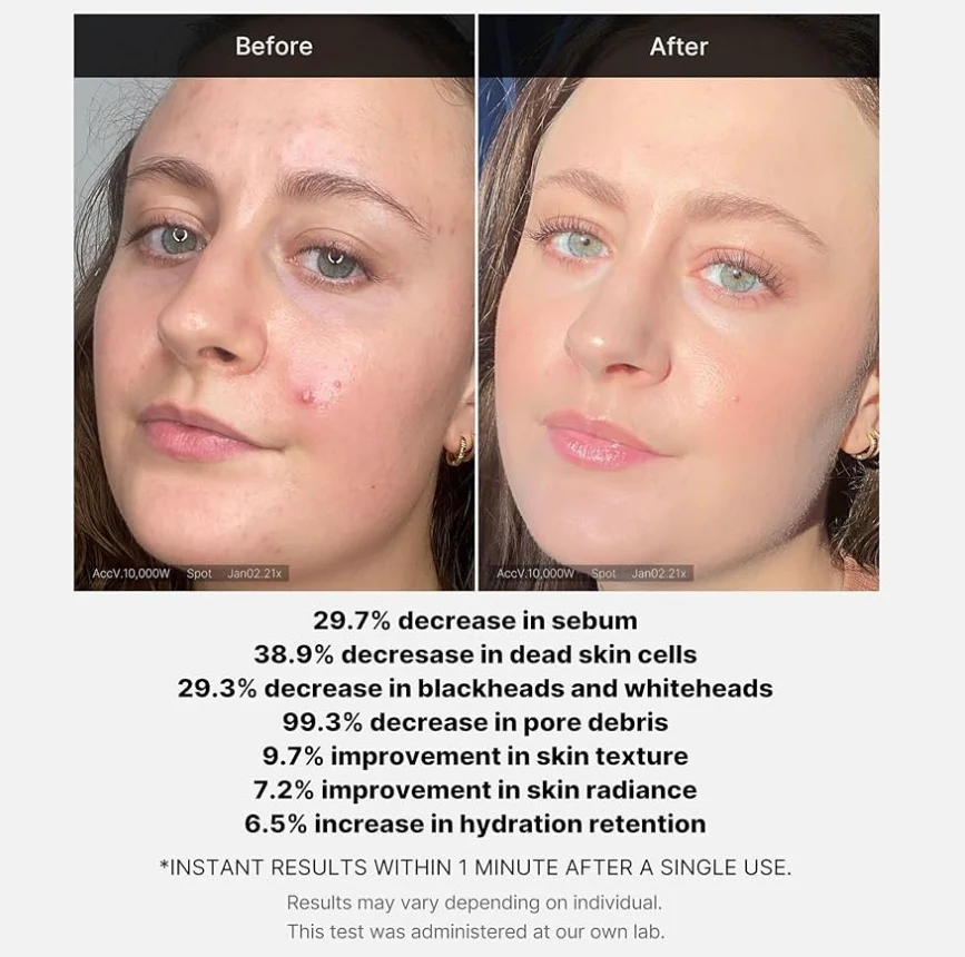 Medicube Red Acne Succinic Acid Peel 40g - Image 7