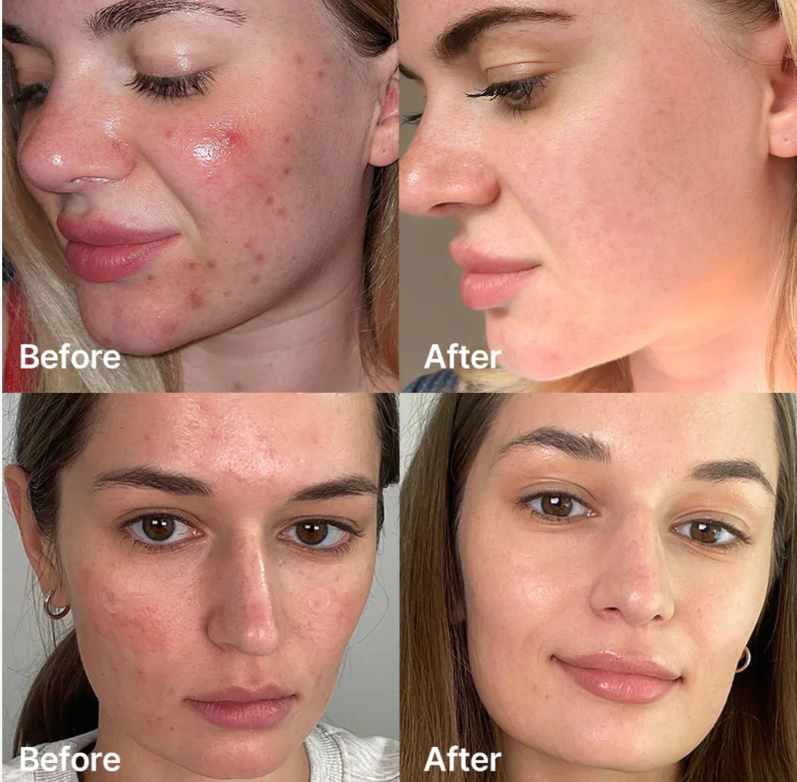 Medicube Red Succinic Acid Serum - Image 4