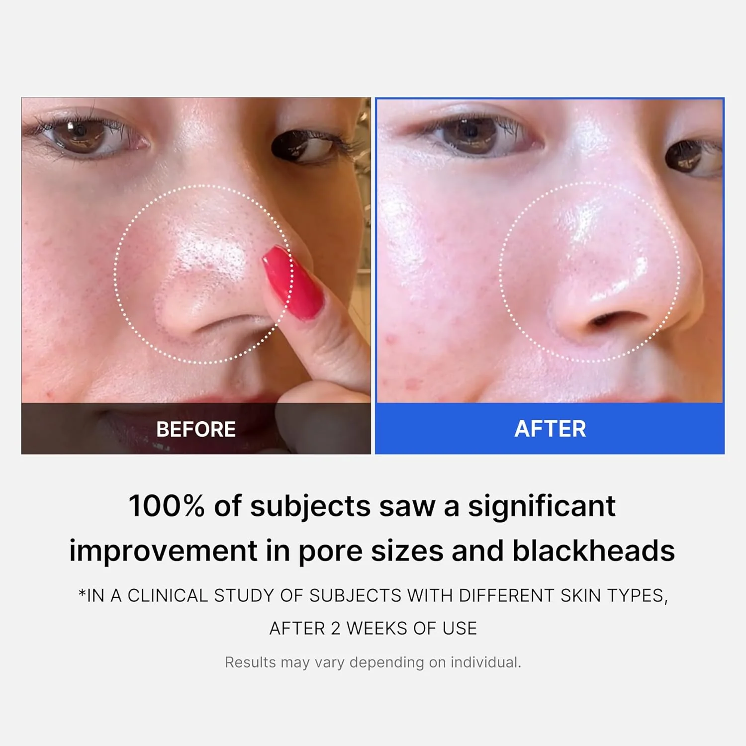 Medicube Zero Pore Pads - Image 4
