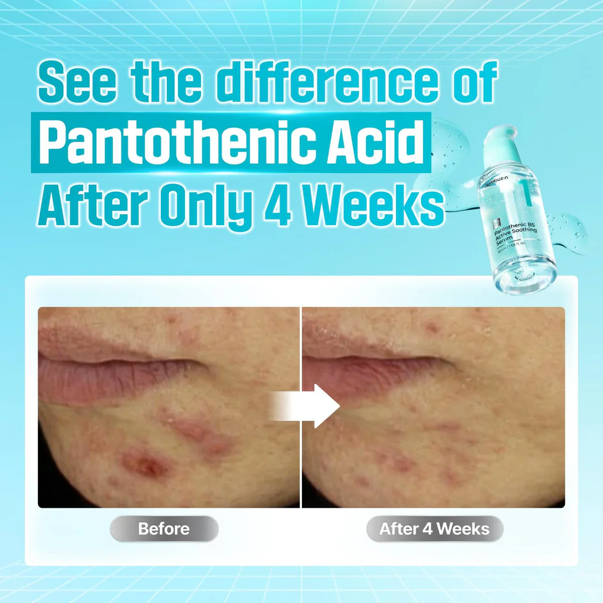 Numbuzin No.1 Pantothenic B5 Active Soothing Serum - Image 3