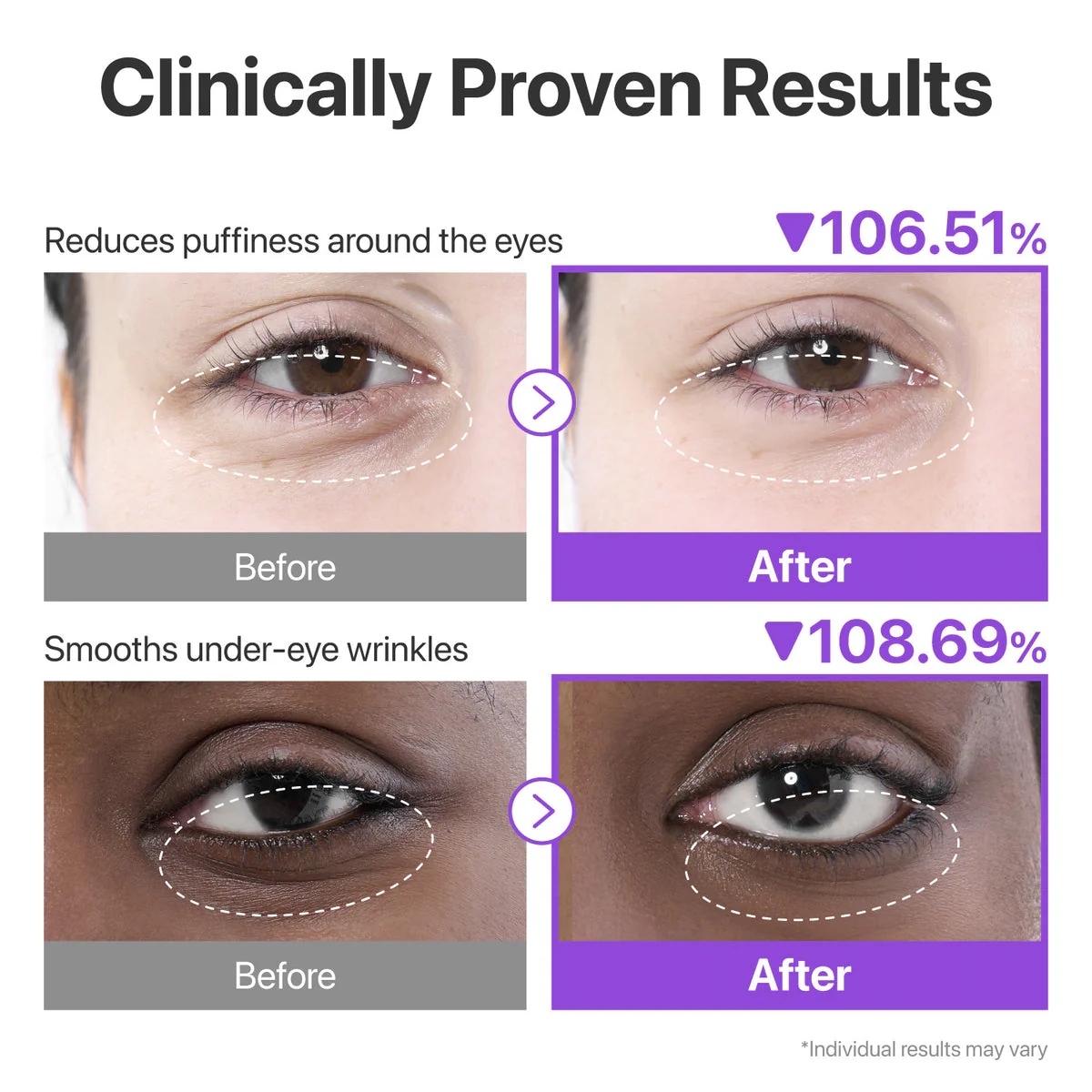 Numbuzin NAD+ collagen under eye patches - Image 4