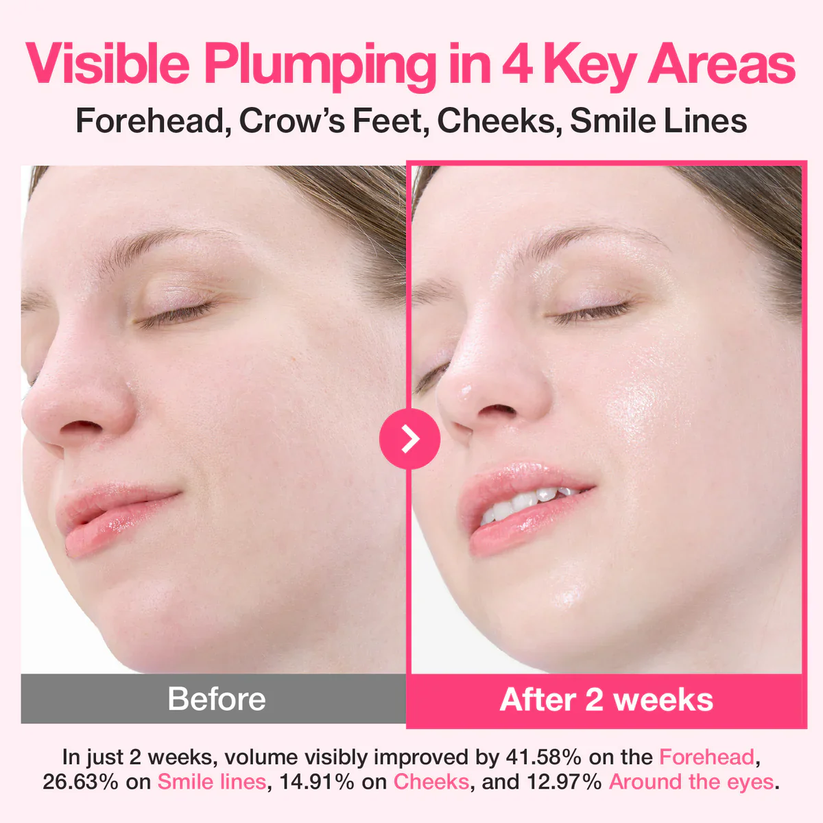 Numbuzin Rose PDRN Collagen Plumping Serum - Image 5