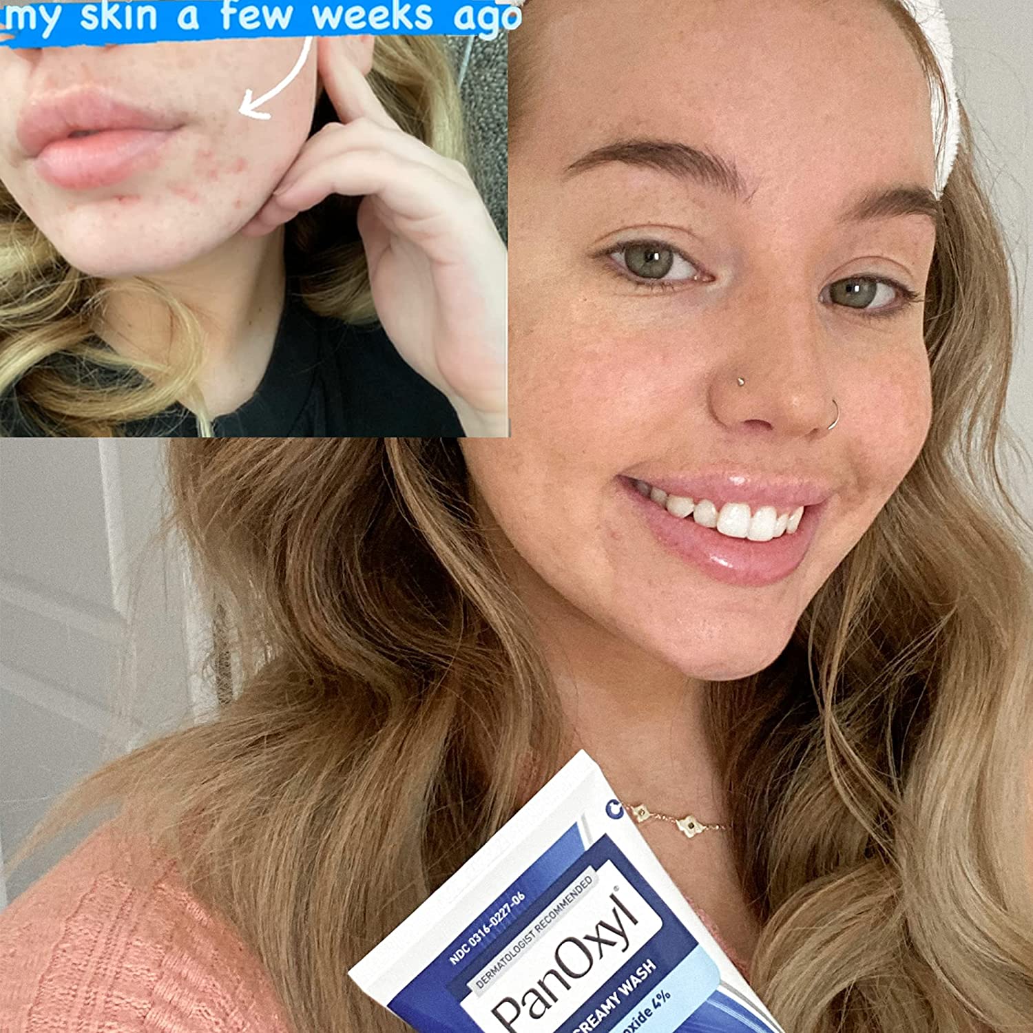 PanOxyl Acne Creamy Wash Benzoyl Peroxide 4% Daily Control - Image 3