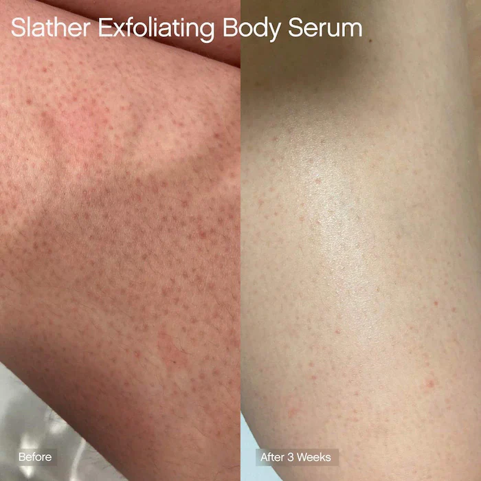 Topicals Slather Exfoliating Body Serum with Retinol and AHAs - Image 3