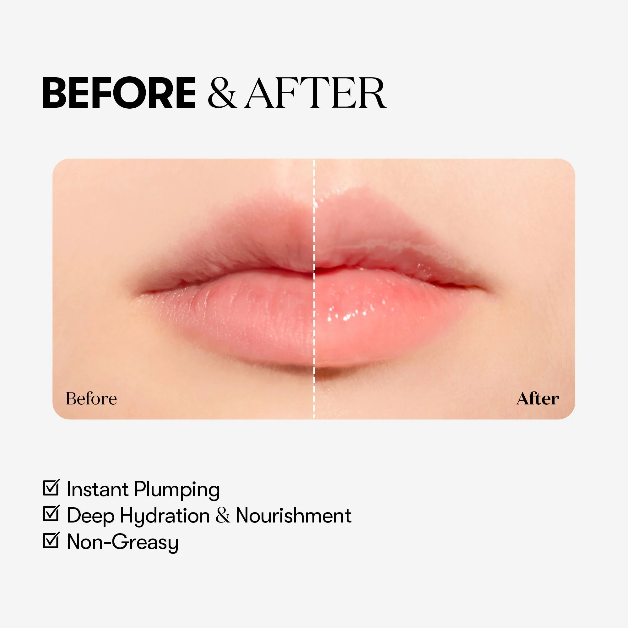 VT COSMETICS Reedle Shot Lip Plumper – Beginner - Image 5